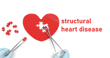 Structural Heart Disease Treatment  