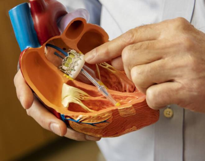 TAVR